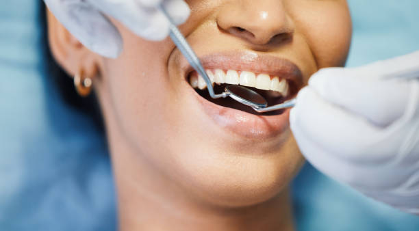 Best Walk-In Emergency Dental Services in Van, TX
