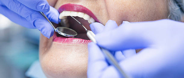 Best Broken or Chipped Tooth Repair in Van, TX