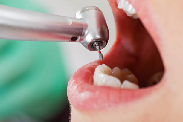 Professional Emergency Dental Service in TX